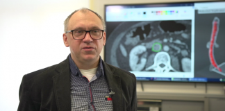 Druk 3D nadzieją onkologii. Polscy naukowcy wydrukowali trójwymiarowy model żyły zajętej nowotworem, co pozwoliło na skuteczną operację
