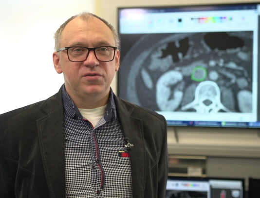 Druk 3D nadzieją onkologii. Polscy naukowcy wydrukowali trójwymiarowy model żyły zajętej nowotworem, co pozwoliło na skuteczną operację